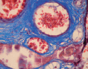 Masson_Trichrome_kit-01